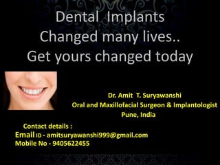 Dental Implants 
Changed many lives.. 
Get yours changed today 
Dr. Amit T. Suryawanshi 
Oral and Maxillofacial Surgeon & Implantologist 
Pune, India 
Contact details : 
Email ID - amitsuryawanshi999@gmail.com 
Mobile No - 9405622455 
 