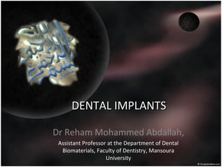 DENTAL IMPLANTSDENTAL IMPLANTS
Dr Reham Mohammed Abdallah,
Assistant Professor at the Department of Dental
Biomaterials, Faculty of Dentistry, Mansoura
University
 