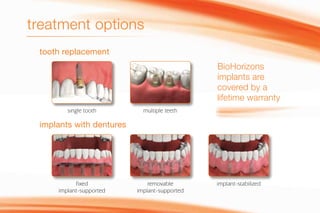 implants with dentures
tooth replacement
single tooth multiple teeth
removable
implant-supported
fixed
implant-supported
implant-stabilized
treatment options
BioHorizons
implants are
covered by a
lifetime warranty
 