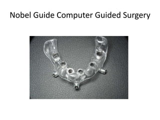 Nobel Guide Computer Guided Surgery
 