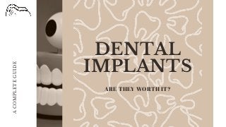 DENTAL
IMPLANTS
ARE THEY WORTH IT?
ACOMPLETEGUIDE
 