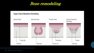 Bone remodeling
 