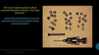 For more informations about
mucosal implants please visit this
web site :
https://pocketdentistry.com/16-
intramucosal-insert-surgery-and-
prosthodontics/
 