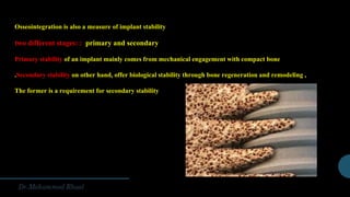 Osseointegration is also a measure of implant stability
two different stages: : primary and secondary
Primary stability of an implant mainly comes from mechanical engagement with compact bone
,Secondary stability on other hand, offer biological stability through bone regeneration and remodeling.
The former is a requirement for secondary stability
 