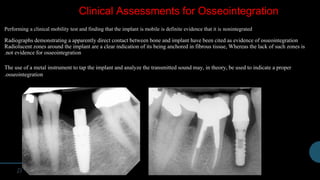Clinical Assessments for Osseointegration
Performing a clinical mobility test and finding that the implant is mobile is definite evidence that it is nonintegrated
Radiographs demonstrating a apparently direct contact between bone and implant have been cited as evidence of osseointegration
Radiolucent zones around the implant are a clear indication of its being anchored in fibrous tissue, Whereas the lack of such zones is
not evidence for osseointegration.
The use of a metal instrument to tap the implant and analyze the transmitted sound may, in theory, be used to indicate a proper
osseointegration.
 