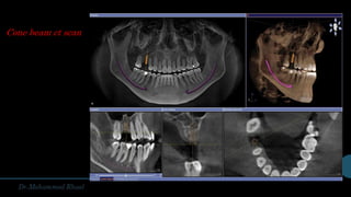 Cone beam ct scan
 
