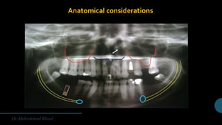 Anatomical considerations
 