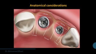 Anatomical considerations
 
