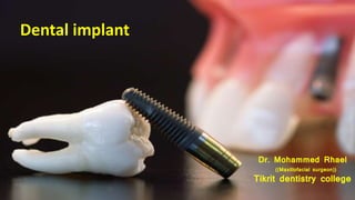 Dental implant
Dr. Mohammed Rhael
((Maxillofacial surgeon))
Tikrit dentistry college
 