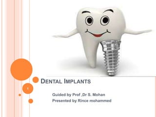 DENTAL IMPLANTS
Guided by Prof ,Dr S. Mohan
Presented by Rince mohammed
1
 