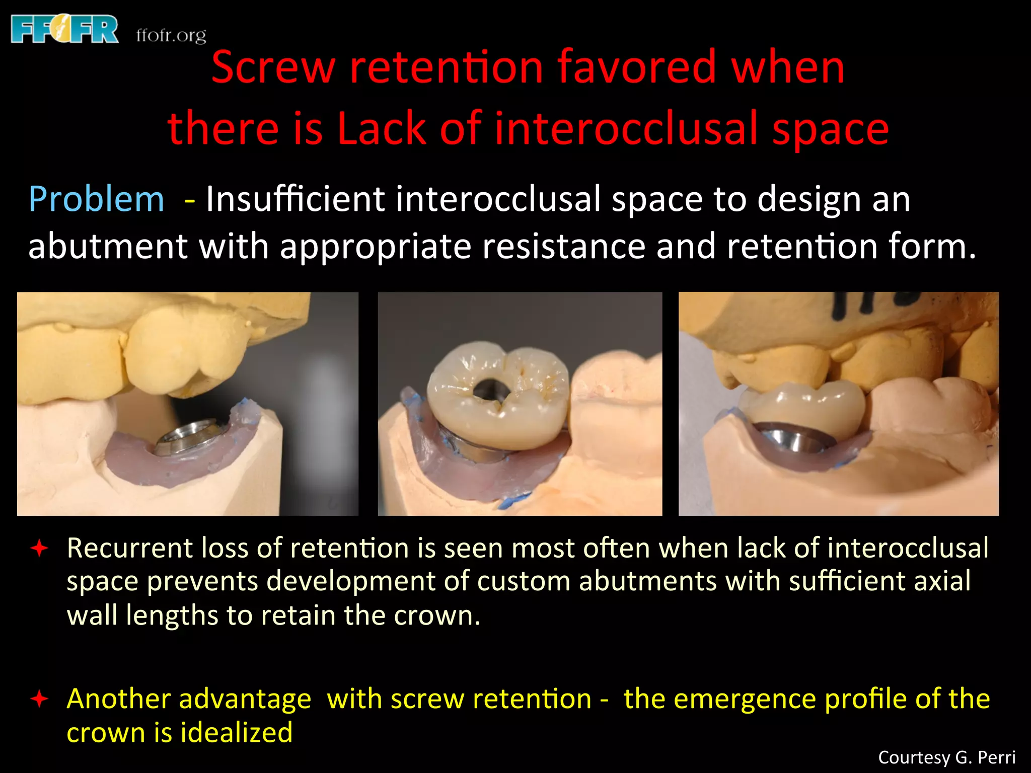 Screw Retention Feature Dental implants cement retention vs screw retention | PPT