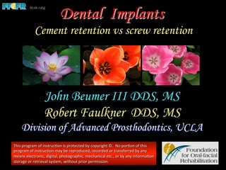 Dental Implants
Cement retention vs screw retention
John Beumer III DDS, MS
Robert Faulkner DDS, MS
Division of Advanced Prosthodontics, UCLA
This	
  program	
  of	
  instruc1on	
  is	
  protected	
  by	
  copyright	
  ©.	
  	
  No	
  por1on	
  of	
  this	
  
program	
  of	
  instruc1on	
  may	
  be	
  reproduced,	
  recorded	
  or	
  transferred	
  by	
  any	
  
means	
  electronic,	
  digital,	
  photographic,	
  mechanical	
  etc.,	
  or	
  by	
  any	
  informa1on	
  
storage	
  or	
  retrieval	
  system,	
  without	
  prior	
  permission.	
  
 