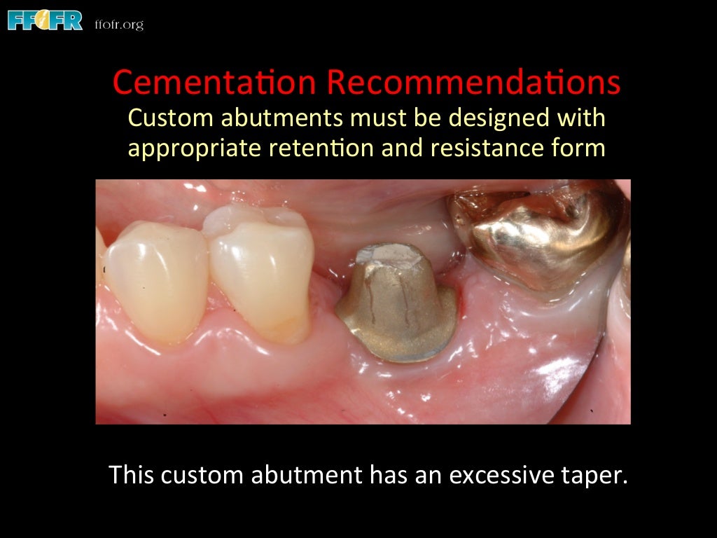 Dental implants cement retention vs screw retention