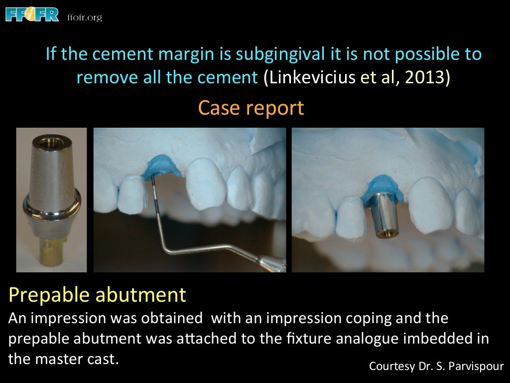 Dental implants cement retention vs screw retention