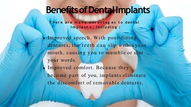 General Dentistry Lafayette Dental Implants At Dental Artistry