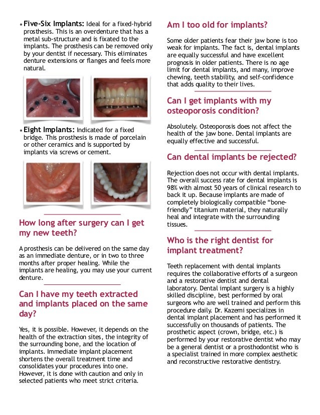 Dental implants for denture users- Dr. kazemi oral-surgery-bethesda