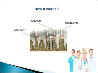 CROWN
IMPLANT
ABUTMENT
How it works?
 
