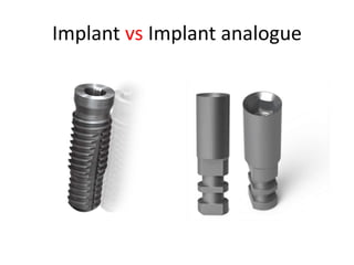 Implant vs Implant analogue
 