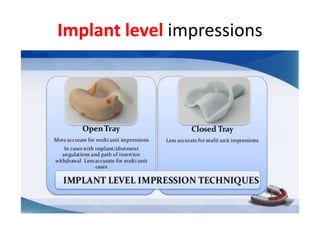 Implant level impressions
 