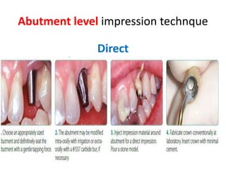 Abutment level impression technque
Direct
 