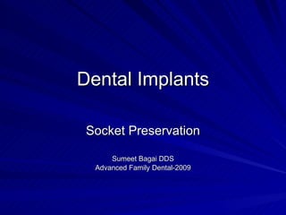 Dental Implants Socket Preservation Sumeet Bagai DDS Advanced Family Dental-2009 