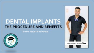 DENTAL IMPLANTS
THE PROCEDURE AND BENEFITS
By Dr. Rajat Sachdeva
No one is you and that is your Power
 