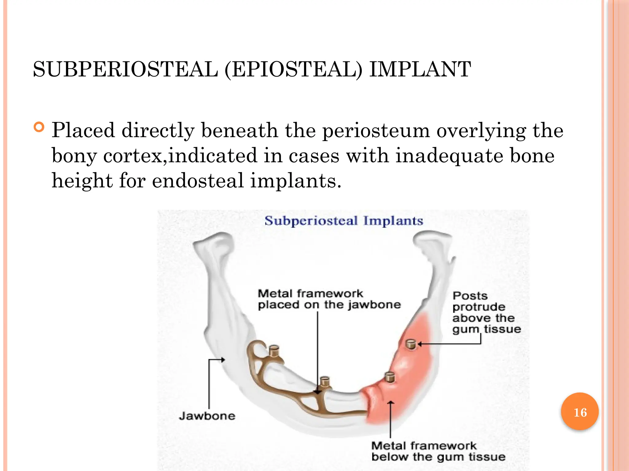 16
SUBPERIOSTEAL (EPIOSTEAL) IMPLANT
 Placed directly beneath the periosteum overlying the
bony cortex,indicated in cases with inadequate bone
height for endosteal implants.
 