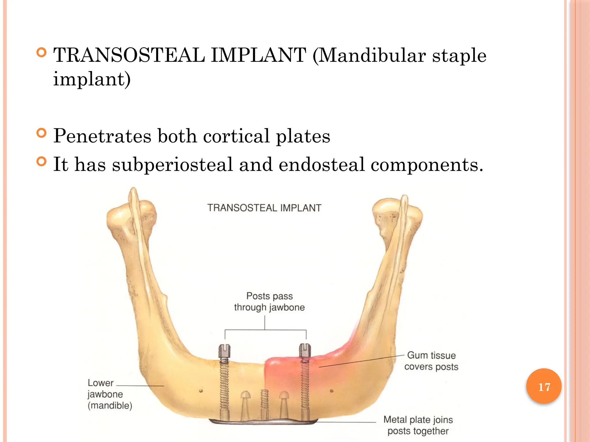 17
 TRANSOSTEAL IMPLANT (Mandibular staple
implant)
 Penetrates both cortical plates
 It has subperiosteal and endosteal components.
 