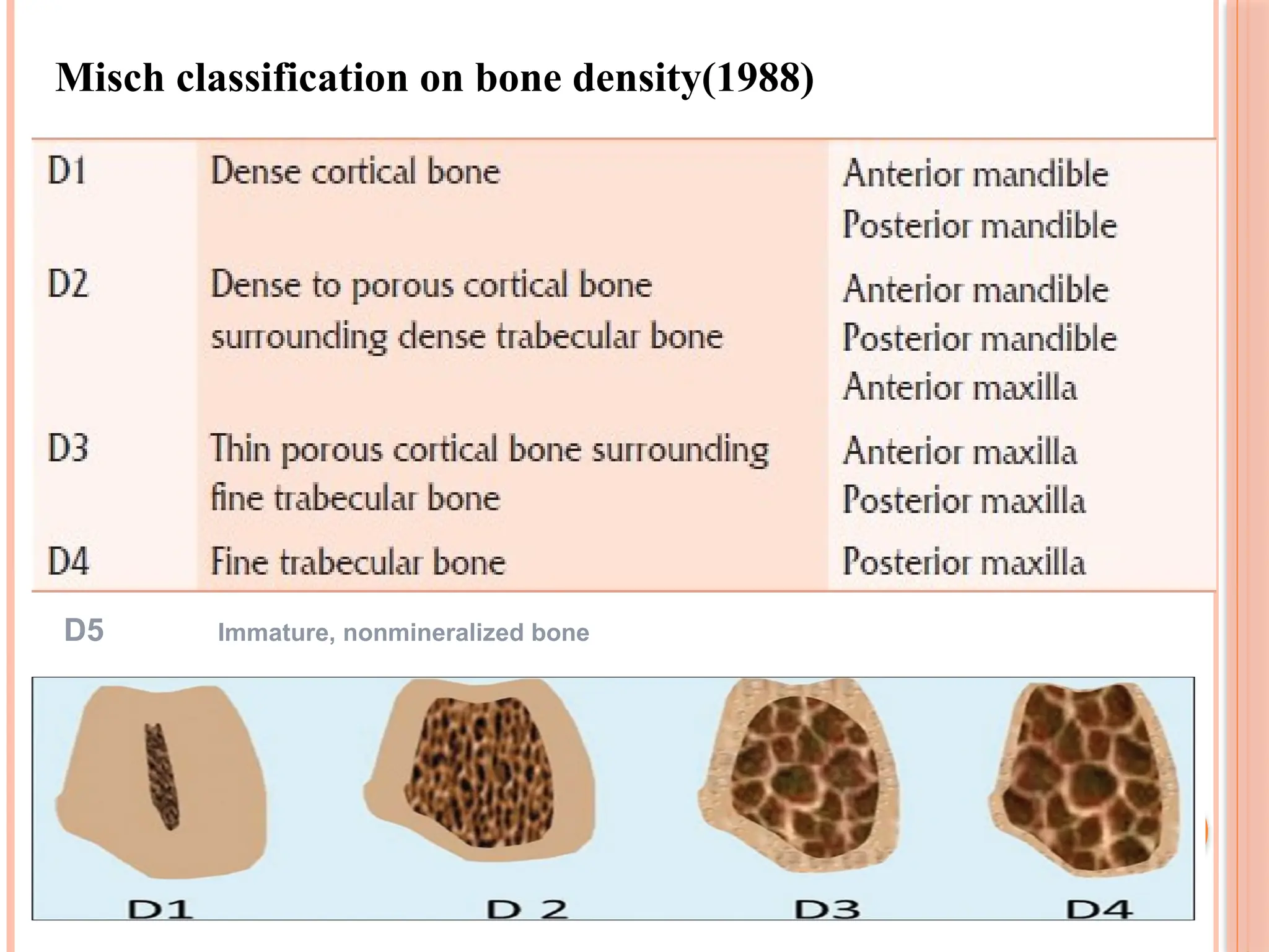 Misch classification on bone density(1988)
D5 Immature, nonmineralized bone
 