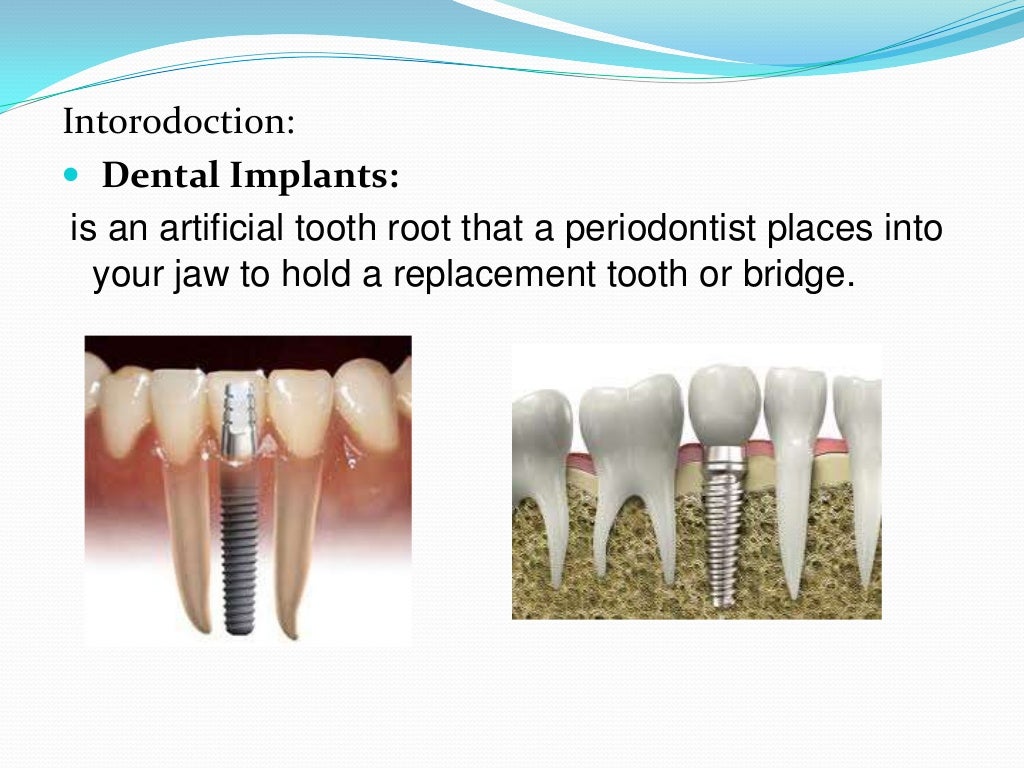 Dental Implants and Osteoporosis