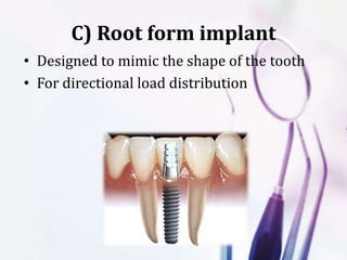 C) Root form implant
• Designed to mimic the shape of the tooth
• For directional load distribution
 