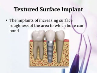 Textured Surface Implant
• The implants of increasing surface
roughness of the area to which bone can
bond
 