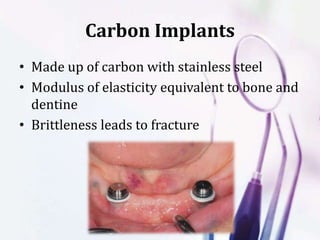 Carbon Implants
• Made up of carbon with stainless steel
• Modulus of elasticity equivalent to bone and
dentine
• Brittleness leads to fracture
 