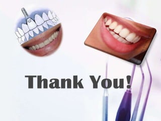 Dental implants by Bhaskar Dewangan