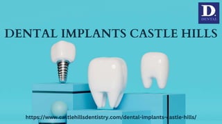 DENTAL IMPLANTS CASTLE HILLS
https://www.castlehillsdentistry.com/dental-implants-castle-hills/
 