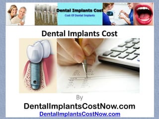 Dental Implants Cost




              By
DentalImplantsCostNow.com
   DentalImplantsCostNow.com
 