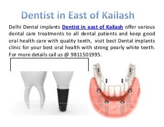 Delhi Dental implants Dentist in east of Kailash offer various
dental care treatments to all dental patients and keep good
l h lth ith lit t th i it b t D t l i l toral health care with quality teeth, visit best Dental implants
clinic for your best oral health with strong pearly white teeth.
For more details call us @ 9811501995The image cannot be displayed. Your computer may not have enough memory to open the image, or the image may have been corrupted. Restart your computer, and then open the file again. If the red x still appears, you may have to delete the image and then insert it again.
For more details call us @ 9811501995.
 