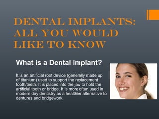 Dental Implants:
All you Would
Like to Know
What is a Dental implant?
It is an artificial root device (generally made up
of titanium) used to support the replacement
tooth/teeth. It is placed into the jaw to hold the
artificial tooth or bridge. It is more often used in
modern day dentistry as a healthier alternative to
dentures and bridgework.
 