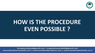 HOW IS THE PROCEDURE
EVEN POSSIBLE ?
 