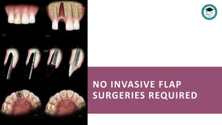 NO INVASIVE FLAP
SURGERIES REQUIRED
 