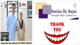 Dental implants in a day 