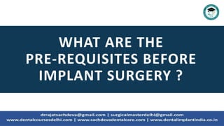 WHAT ARE THE
PRE-REQUISITES BEFORE
IMPLANT SURGERY ?
 