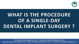 WHAT IS THE PROCEDURE
OF A SINGLE-DAY
DENTAL IMPLANT SURGERY ?
 