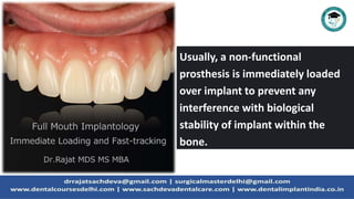 Usually, a non-functional
prosthesis is immediately loaded
over implant to prevent any
interference with biological
stability of implant within the
bone.
 