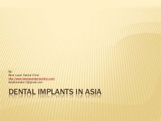 DENTAL IMPLANTS IN ASIA
By-
Best Laser Dental Clinic
http://www.bestlaserdentalclinic.com
bestdentalno1@gmail.com
 