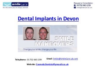 Dental Implants in Devon
Telephone: 01752 663 239 Email: Smile@SmileCare.uk.com
Website: CosmeticDentistsPlymouth.co.uk
 