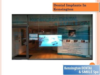 Dental Implants In Kensington 