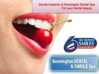 Dental Implants at Kensington Dental Spa 		For your dental beauty 