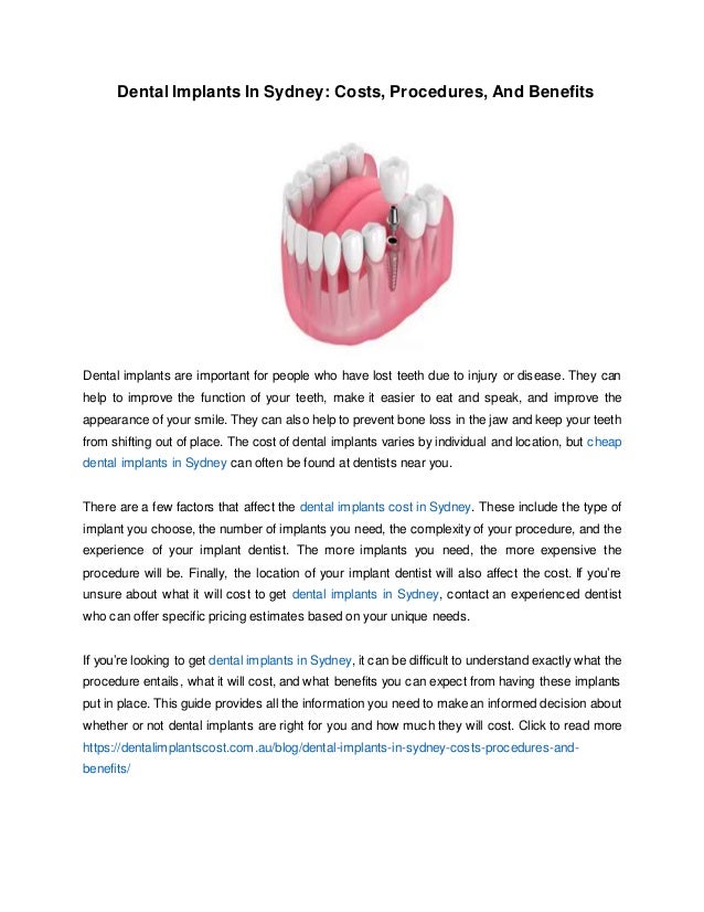 Dental Implants In Sydney Costs, Procedures, And Benefits