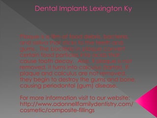Dental implants lexington ky
